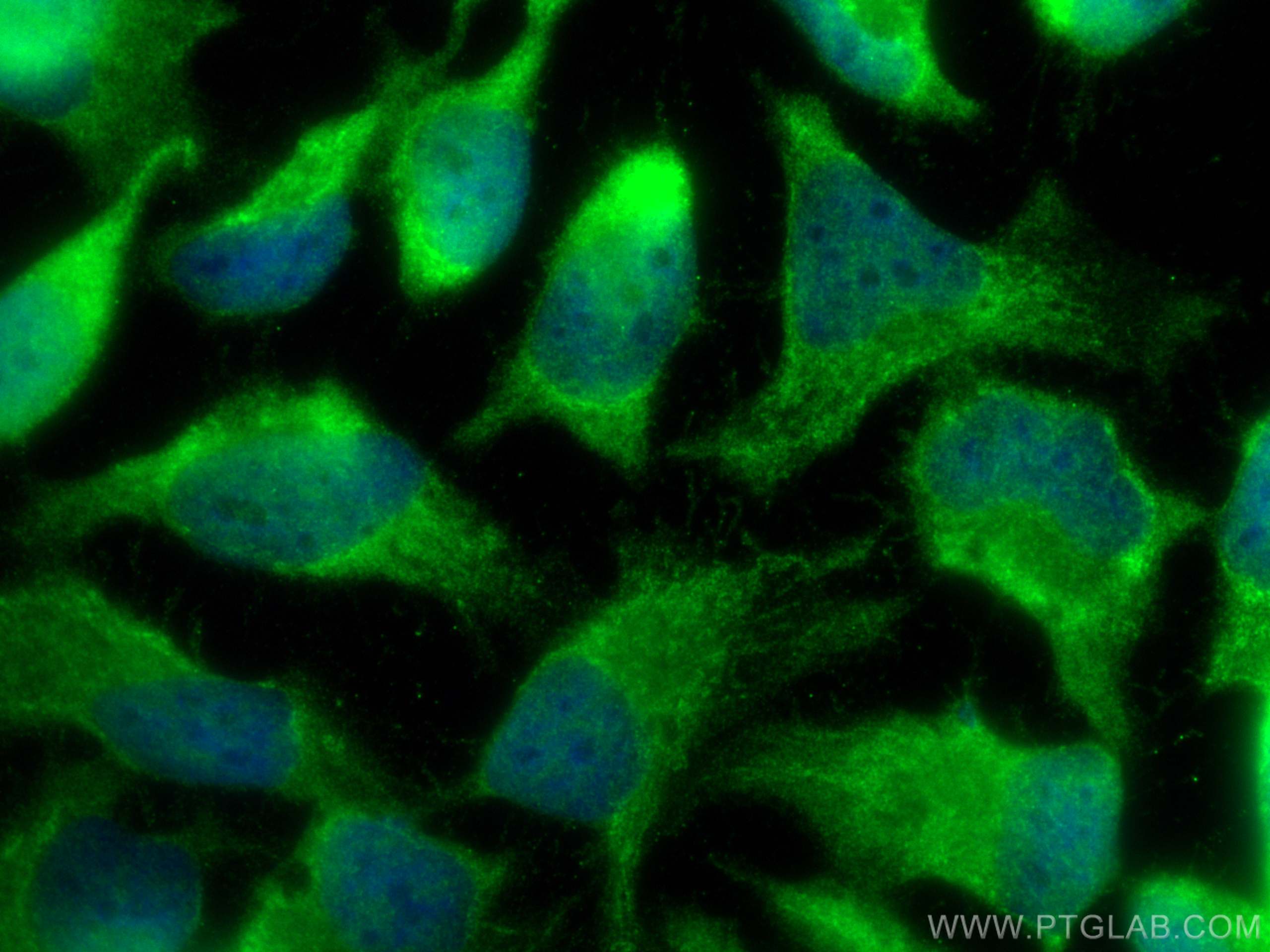 IF Staining of HeLa using 14220-1-AP