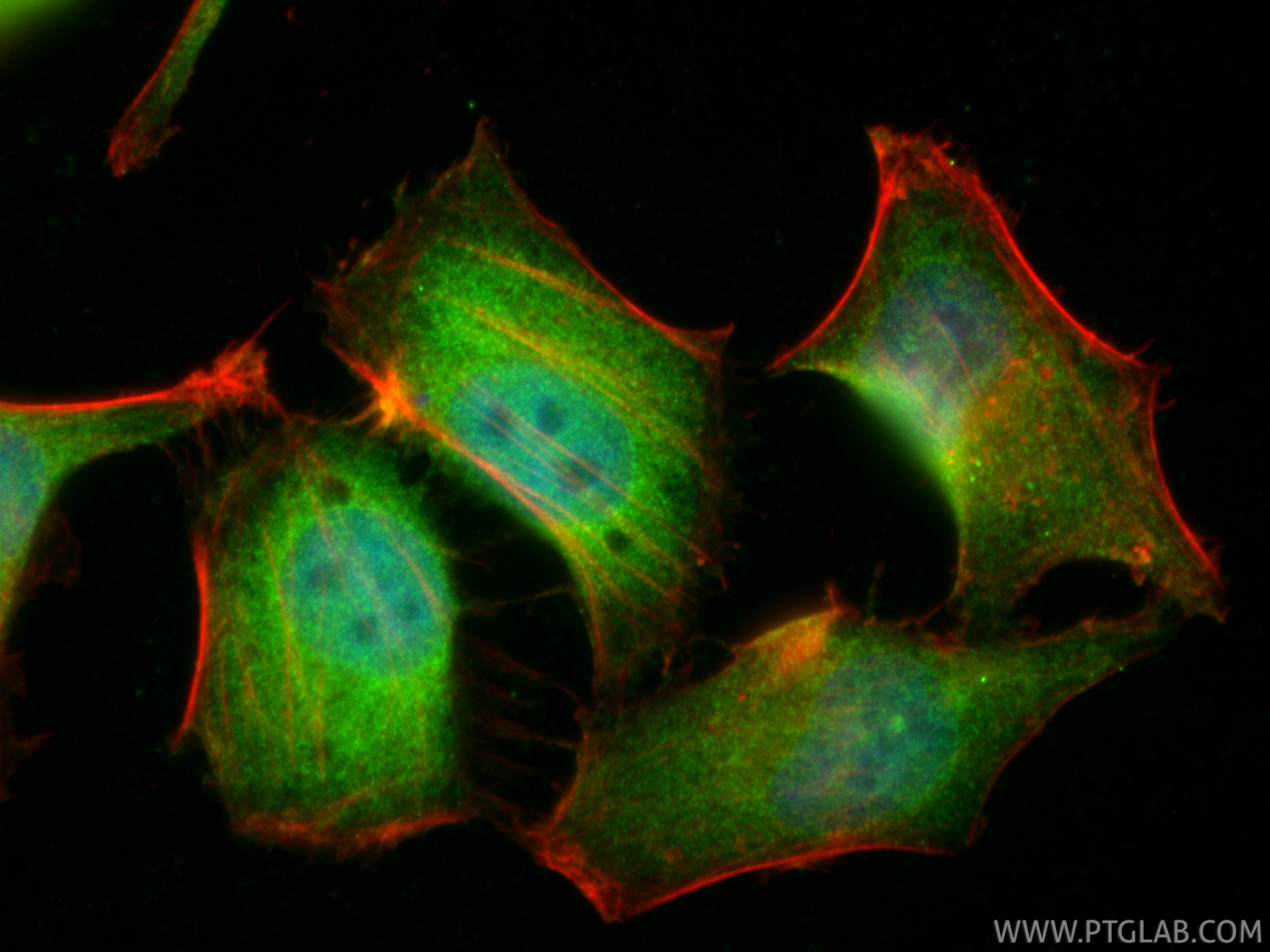 IF Staining of HepG2 using 14220-1-AP
