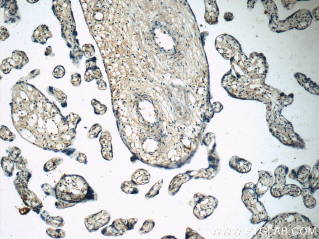 IHC staining of human placenta using 23576-1-AP