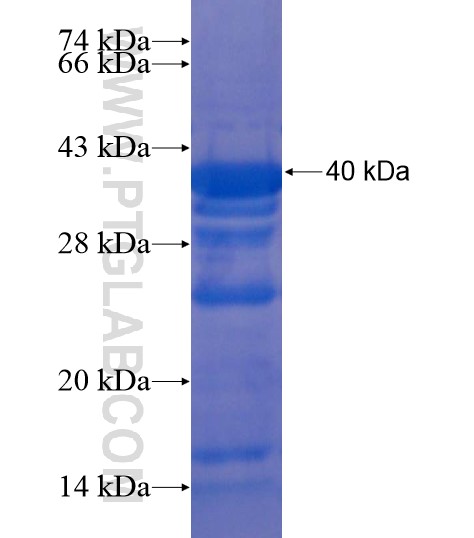 NFKB1 fusion protein Ag20361 SDS-PAGE
