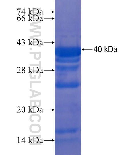 NFKB1 fusion protein Ag20361 SDS-PAGE NFKB1 fusion protein Ag20361 SDS-PAGE
