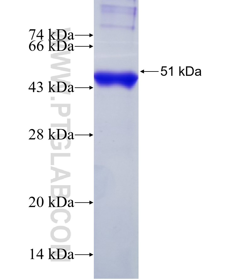 NFKB1 fusion protein Ag5832 SDS-PAGE