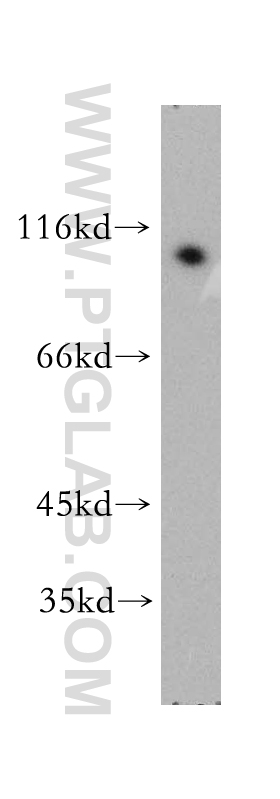 WB analysis of Apoptosised HeLa using 51085-1-AP