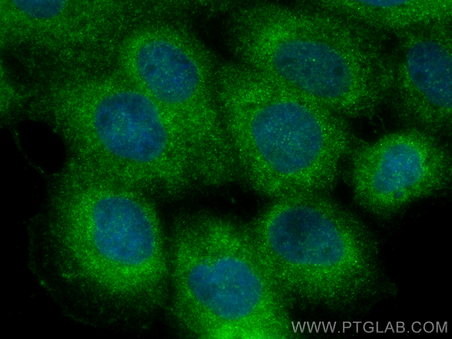 IF Staining of A431 using 10268-1-AP