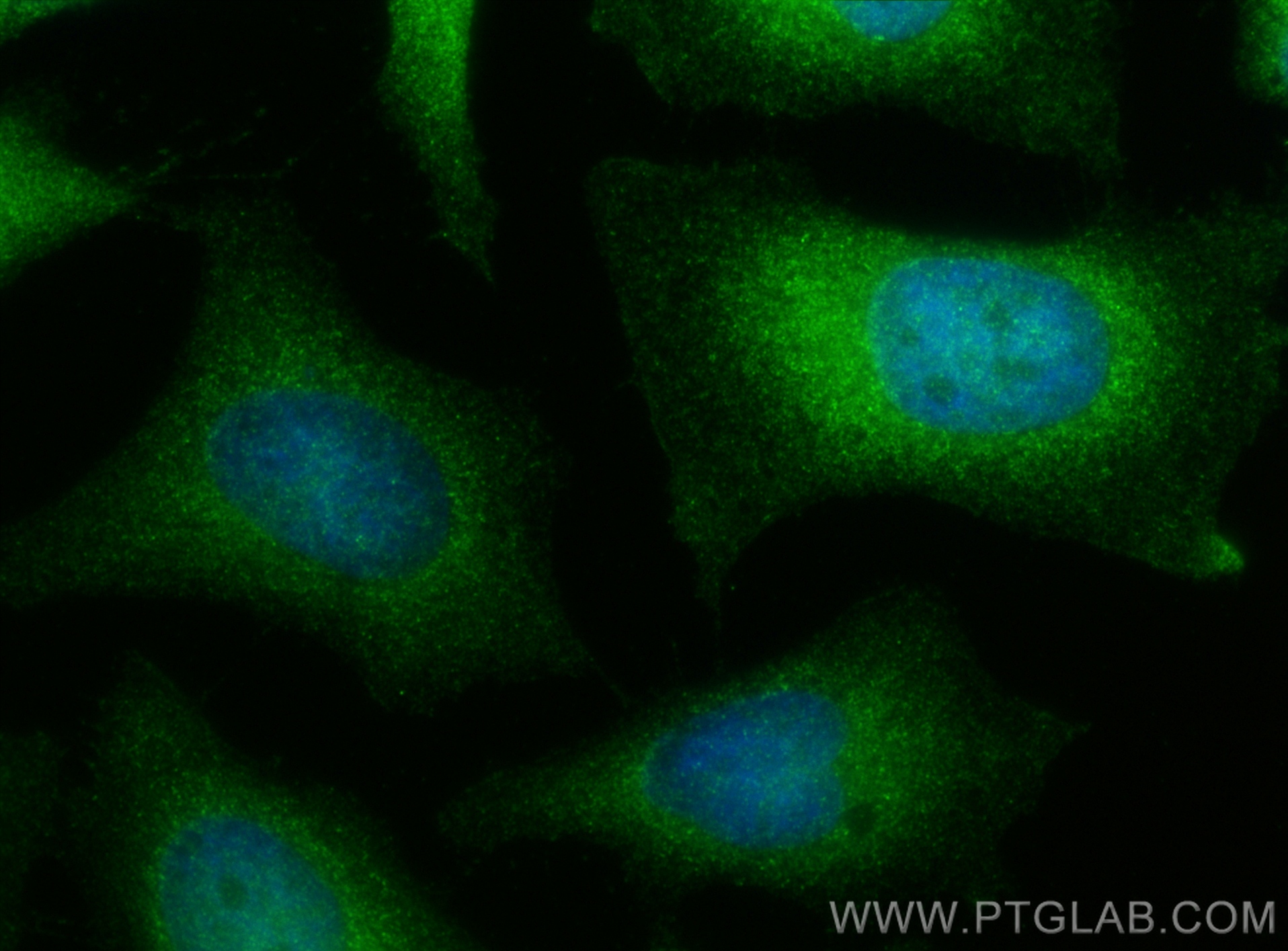 IF Staining of HeLa using 10268-1-AP