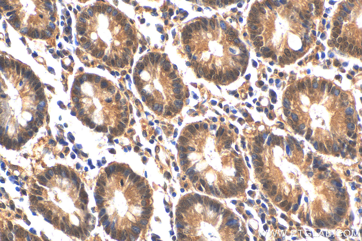 IHC staining of human stomach using 10268-1-AP