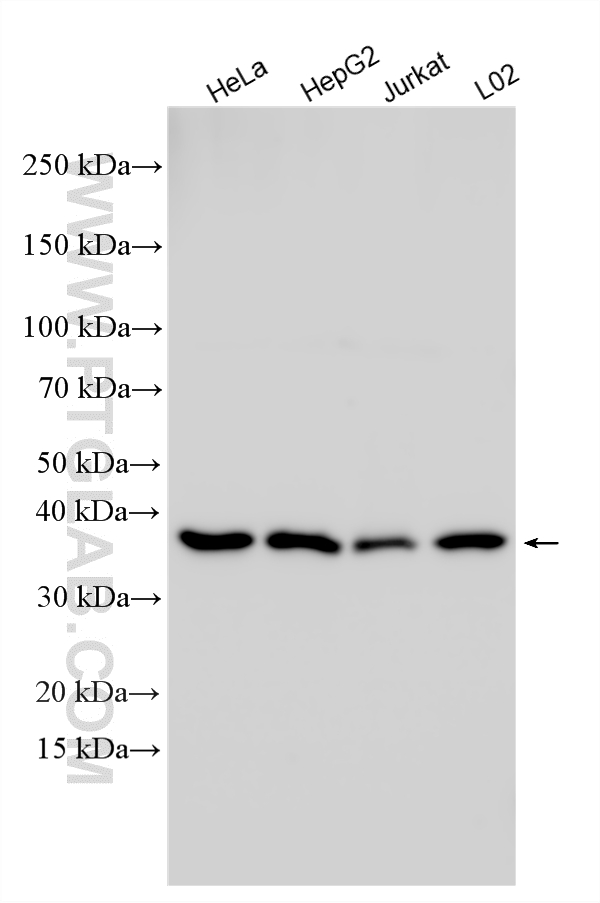 Various lysates were subjected to SDS PAGE followed by western blot with 10268-1-AP (IkB Alpha antibody) at dilution of 1:40000 incubated at room temperature for 1.5 hours. WB analysis using 10268-1-AP