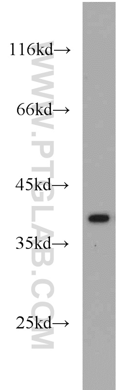 IkB Alpha Polyclonal antibody