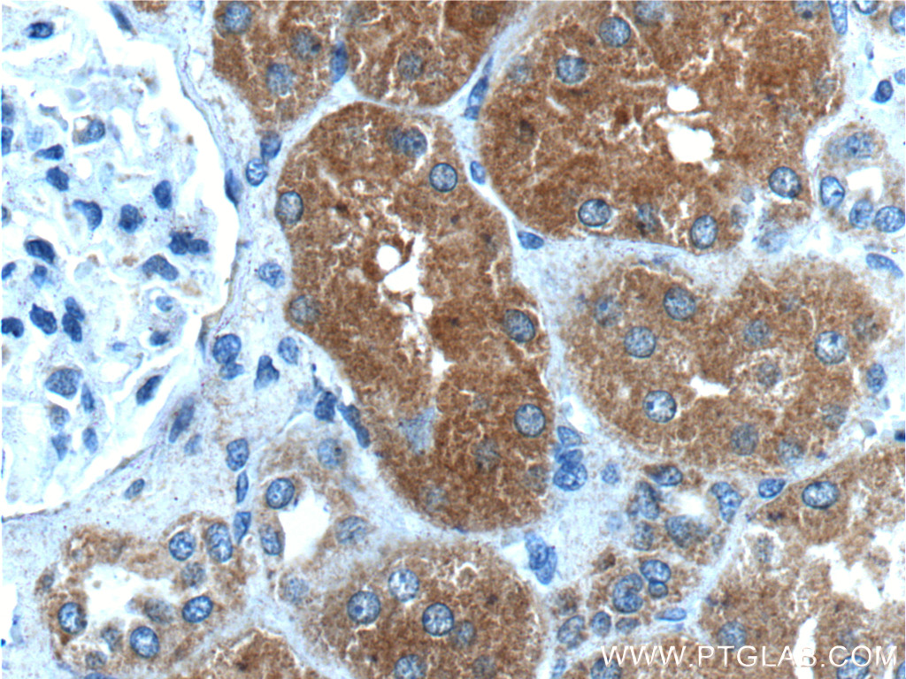 IHC staining of human kidney using 18220-1-AP