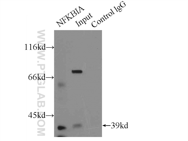 IP experiment of HeLa using 18220-1-AP