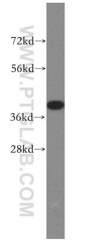 WB analysis of PC-3 using 51066-1-AP