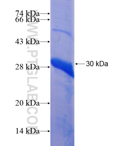 NFKBIA fusion protein Ag22040 SDS-PAGE