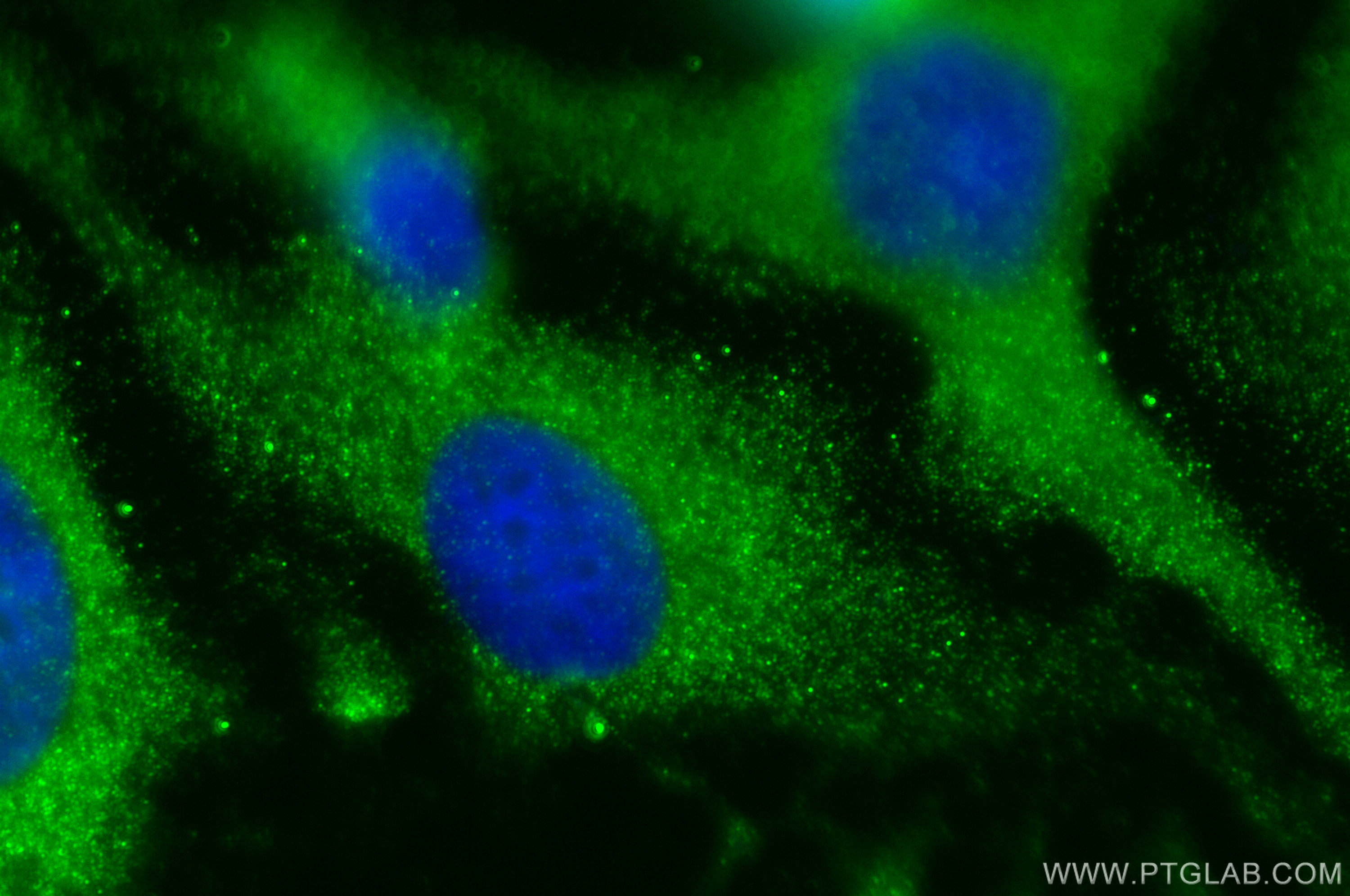 IF Staining of HeLa using 12660-1-AP