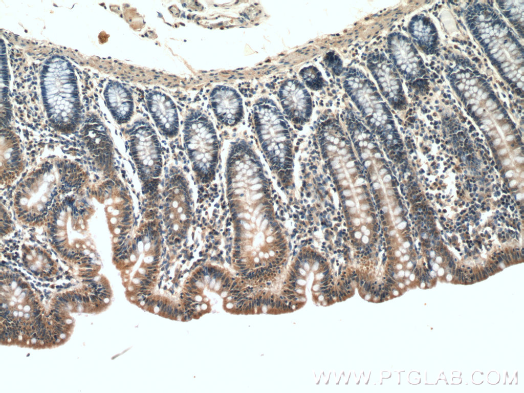 IHC staining of human colon using 12660-1-AP