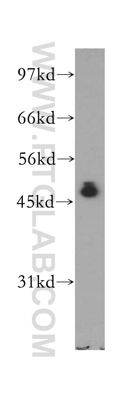 IkB Beta Polyclonal antibody