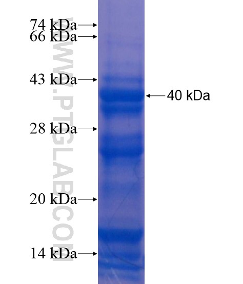 NFKBIL1 fusion protein Ag21978 SDS-PAGE