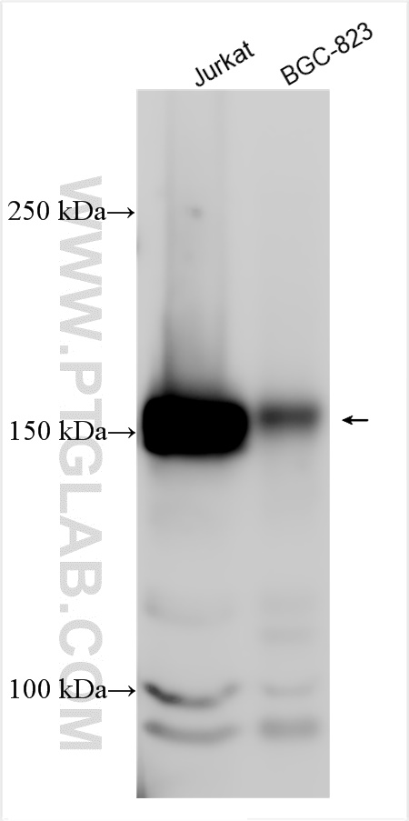 NFRKB