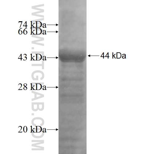 NFRKB fusion protein Ag5357 SDS-PAGE NFRKB fusion protein Ag5357 SDS-PAGE