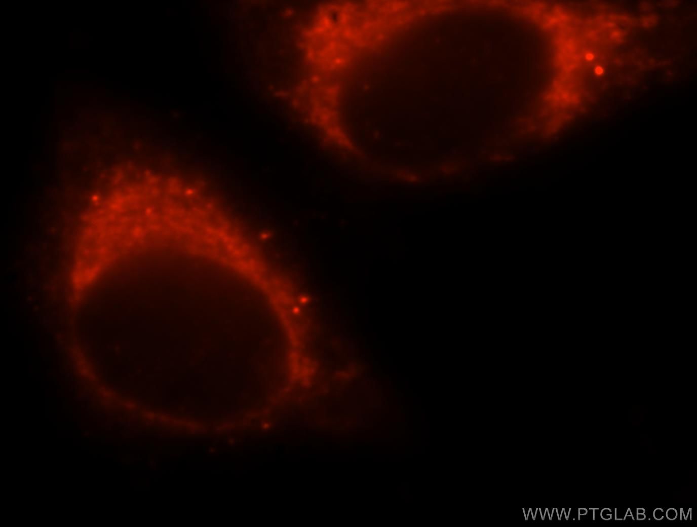 IF Staining of HepG2 using 15370-1-AP