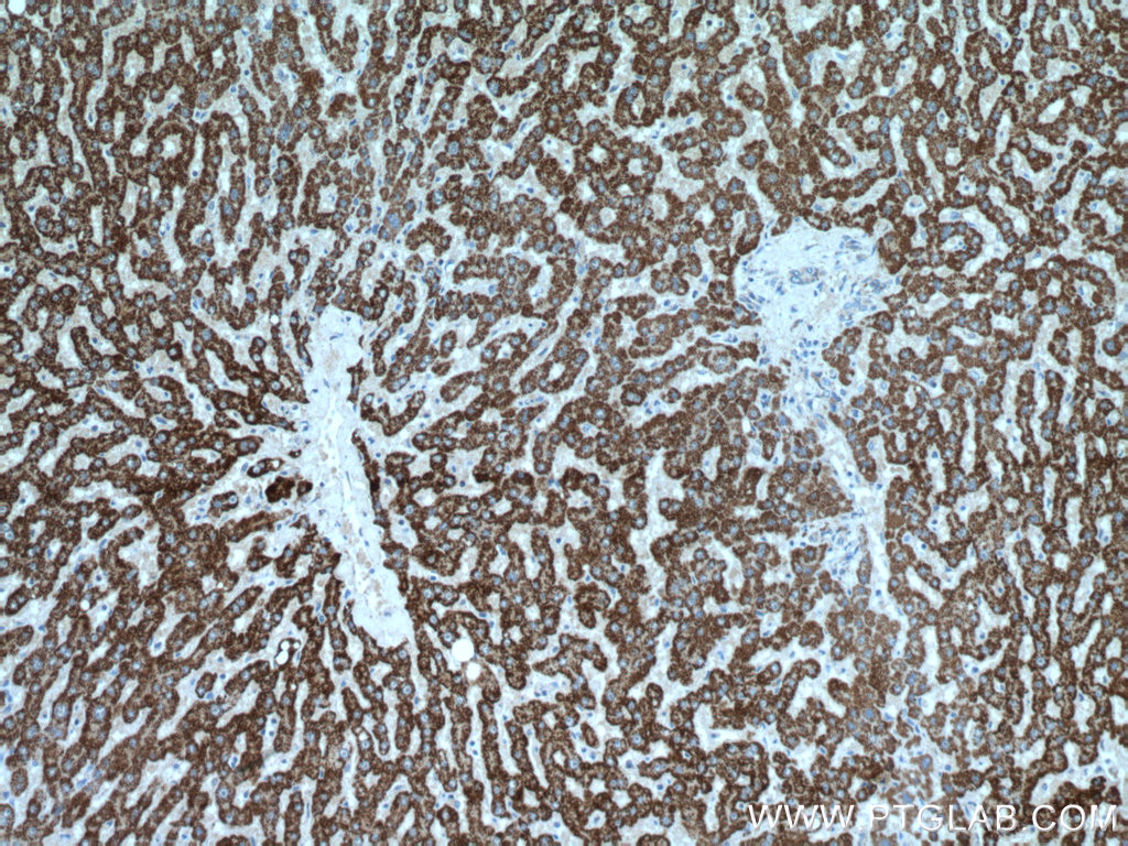 IHC staining of human liver using 15370-1-AP