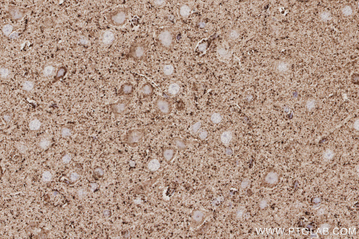 IHC staining of rat brain using 15370-1-AP IHC staining of rat brain using 15370-1-AP