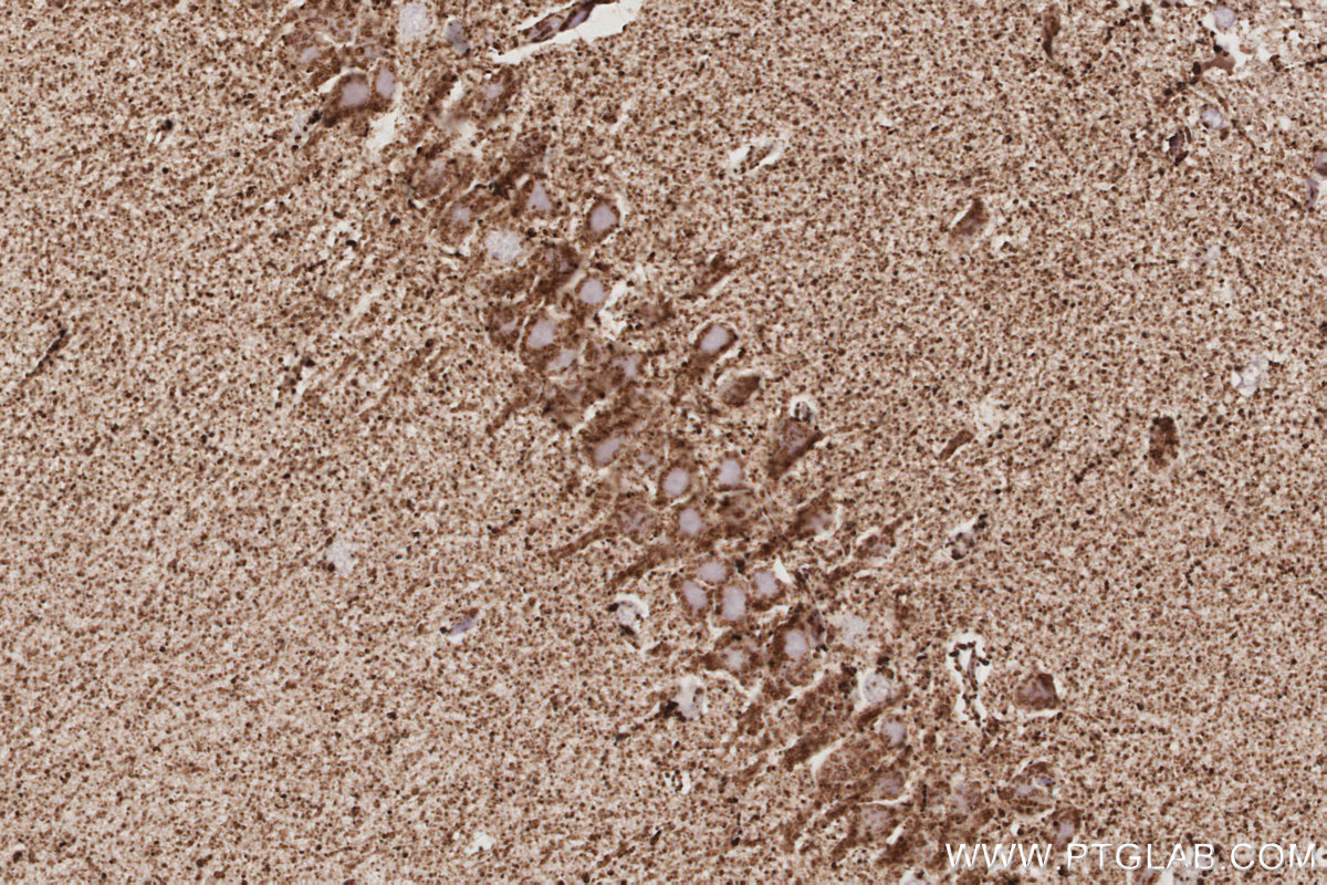 IHC staining of rat brain using 15370-1-AP IHC staining of rat brain using 15370-1-AP