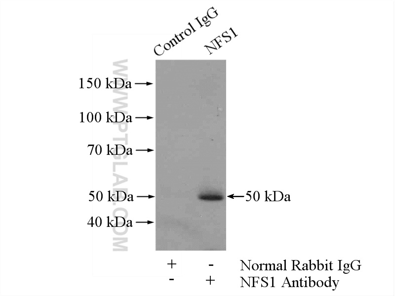 IP experiment of HepG2 using 15370-1-AP