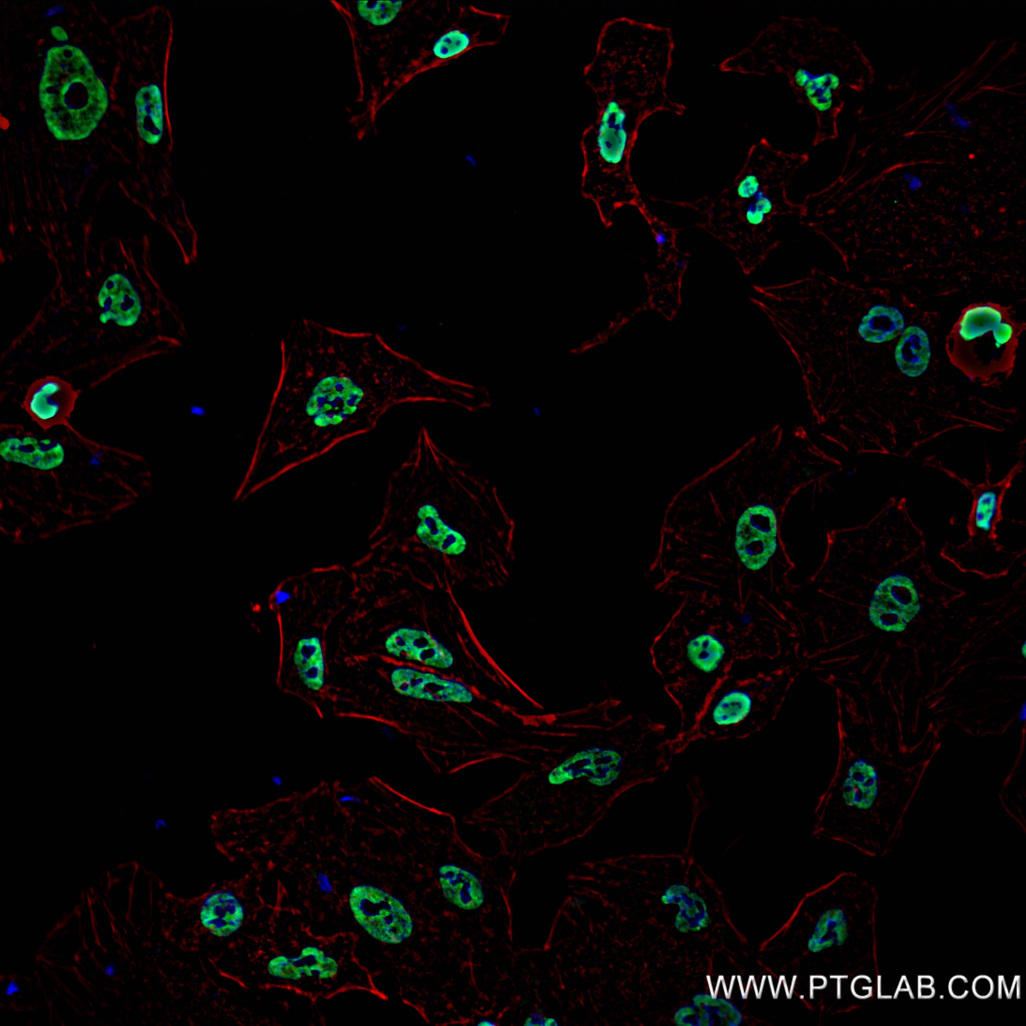 IF Staining of HeLa using 82924-1-RR (same clone as 82924-1-PBS)