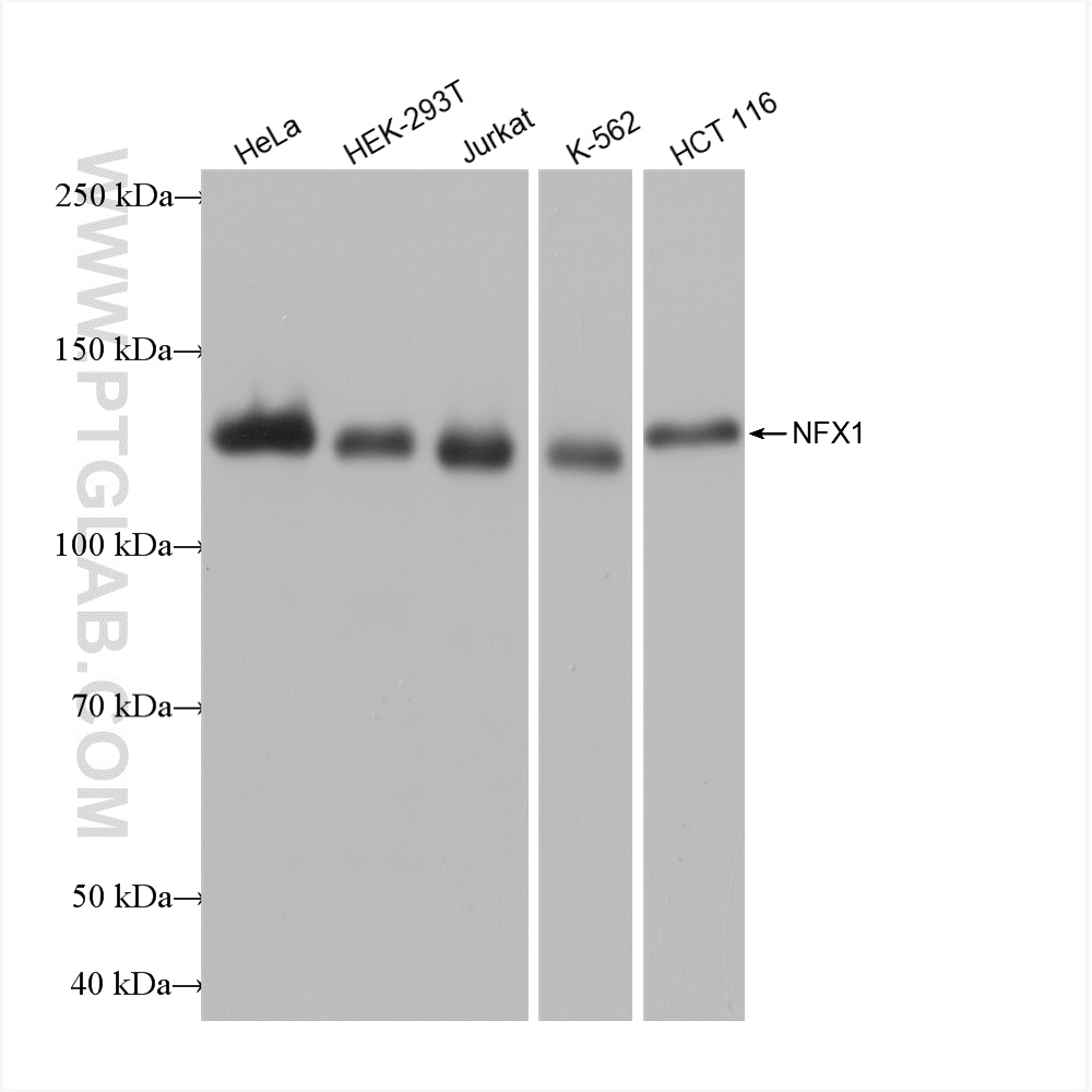 WB analysis using 82924-2-RR