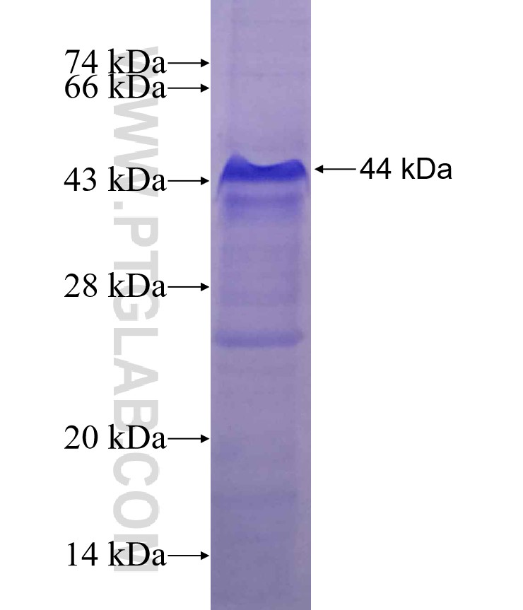 NFX1 fusion protein Ag9474 SDS-PAGE NFX1 fusion protein Ag9474 SDS-PAGE