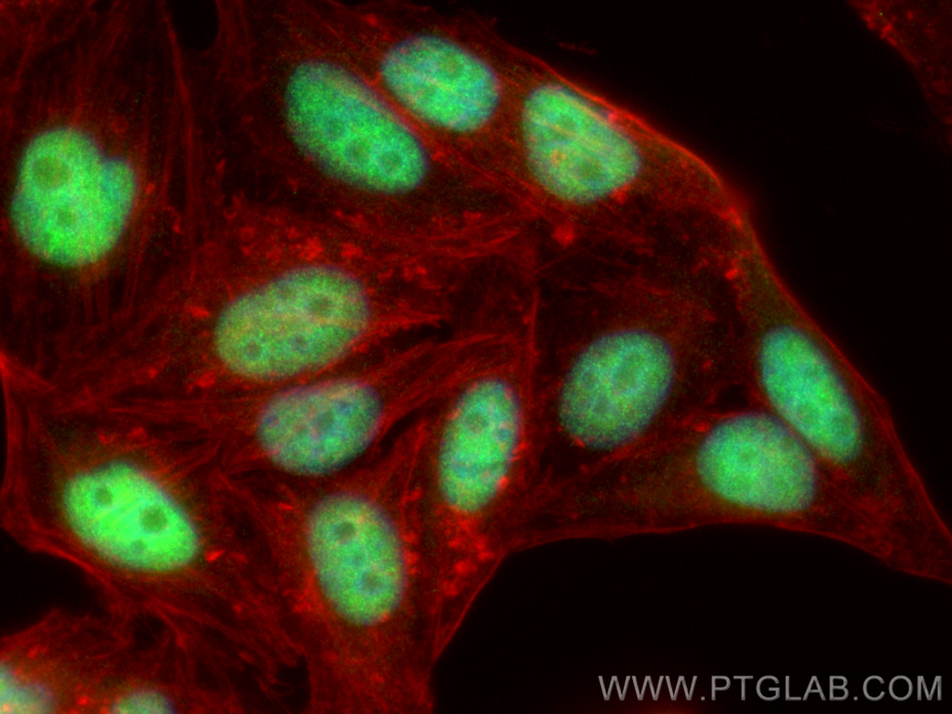 IF Staining of HepG2 using 12981-1-AP
