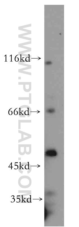 WB analysis of K-562 using 10129-2-AP