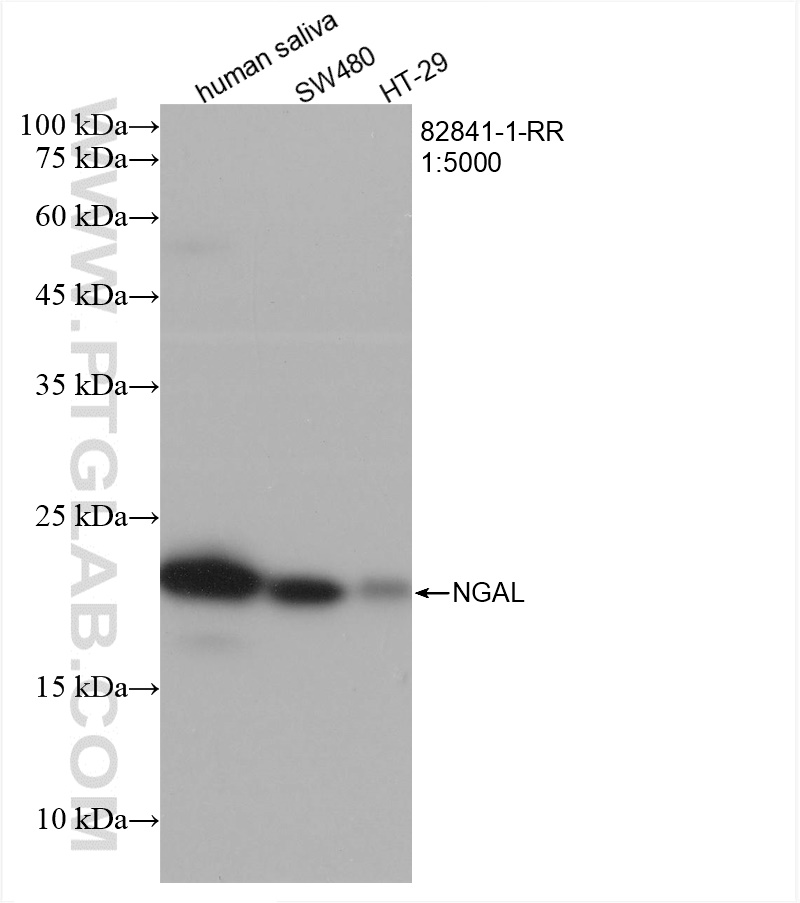 WB analysis using 82841-1-RR (same clone as 82841-1-PBS)
