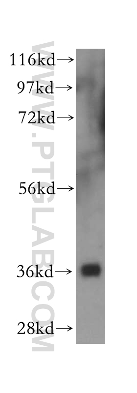 WB analysis of human cerebellum using 16524-1-AP