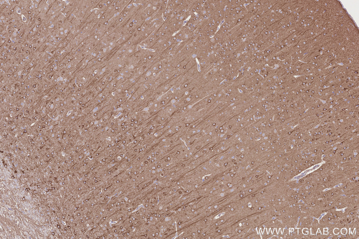 IHC staining of rat brain using 30229-1-AP IHC staining of rat brain using 30229-1-AP