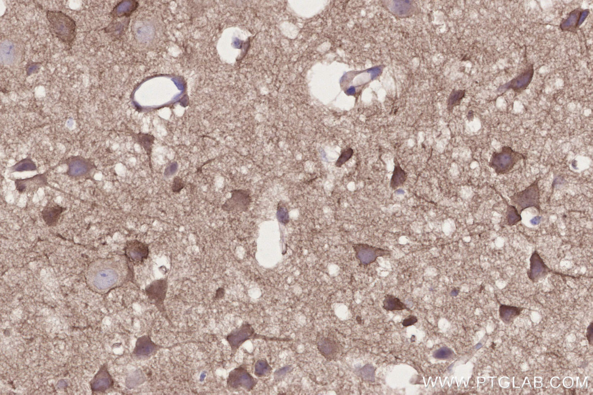 IHC staining of mouse brain using 30229-1-AP IHC staining of mouse brain using 30229-1-AP
