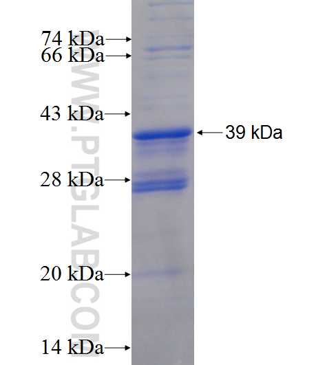 NGF fusion protein Ag25370 SDS-PAGE NGF fusion protein Ag25370 SDS-PAGE