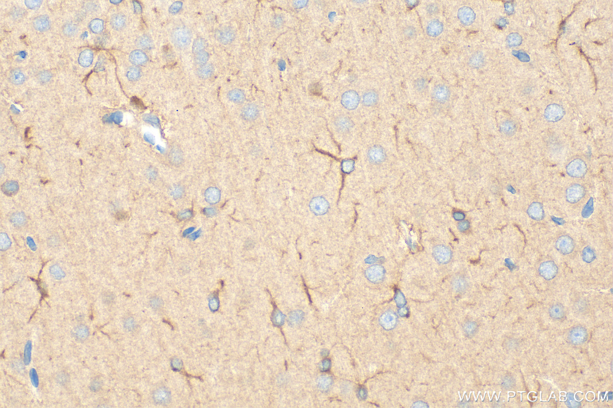 IHC staining of rat brain using 32505-1-AP