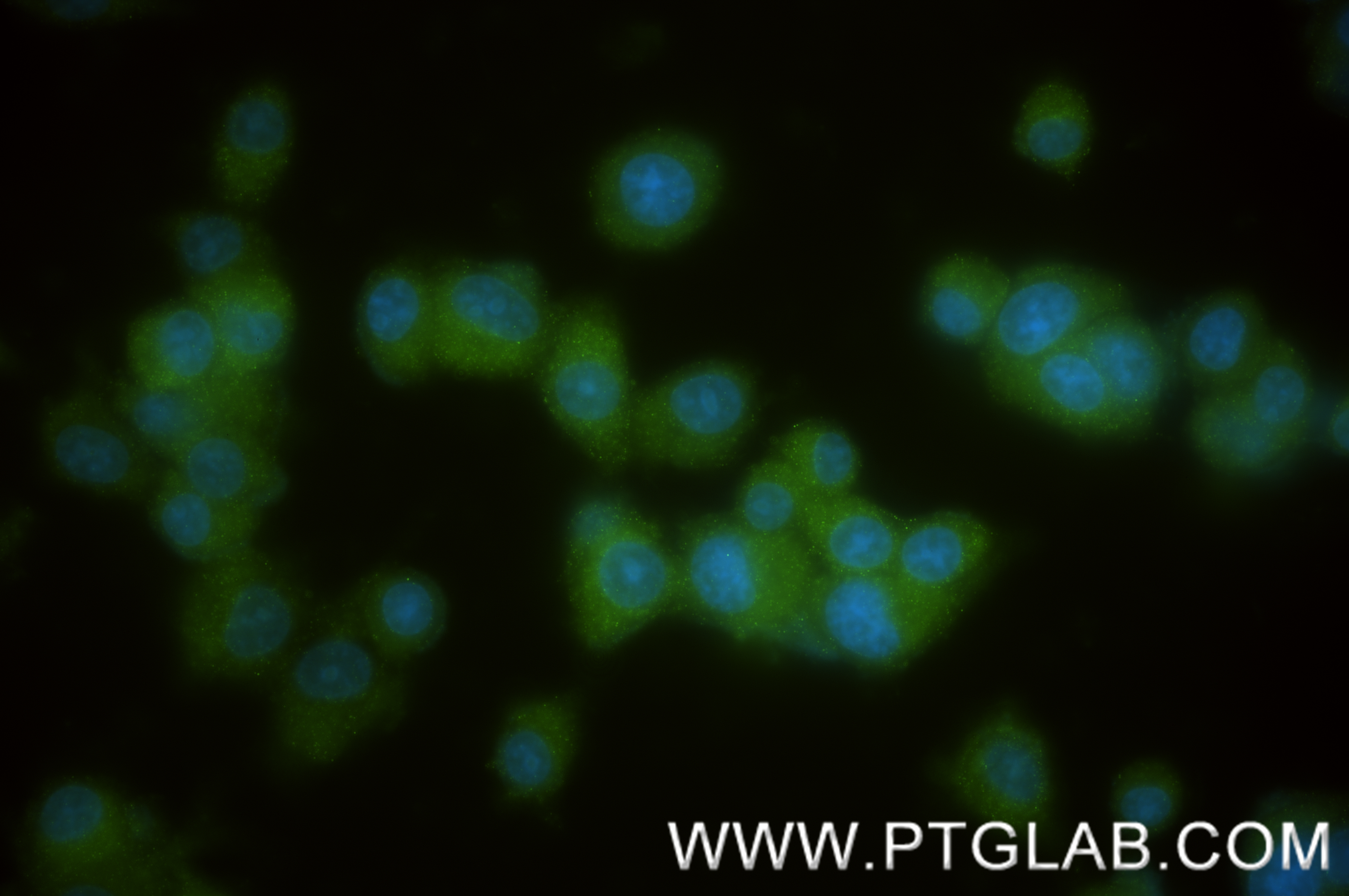 IF Staining of PC-12 using 85622-2-RR