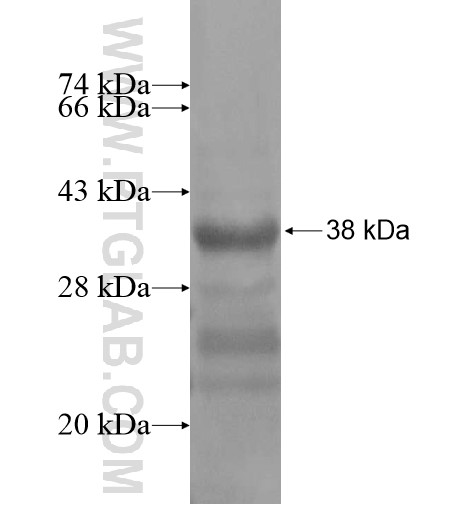 NHEDC1 fusion protein Ag14662 SDS-PAGE NHEDC1 fusion protein Ag14662 SDS-PAGE