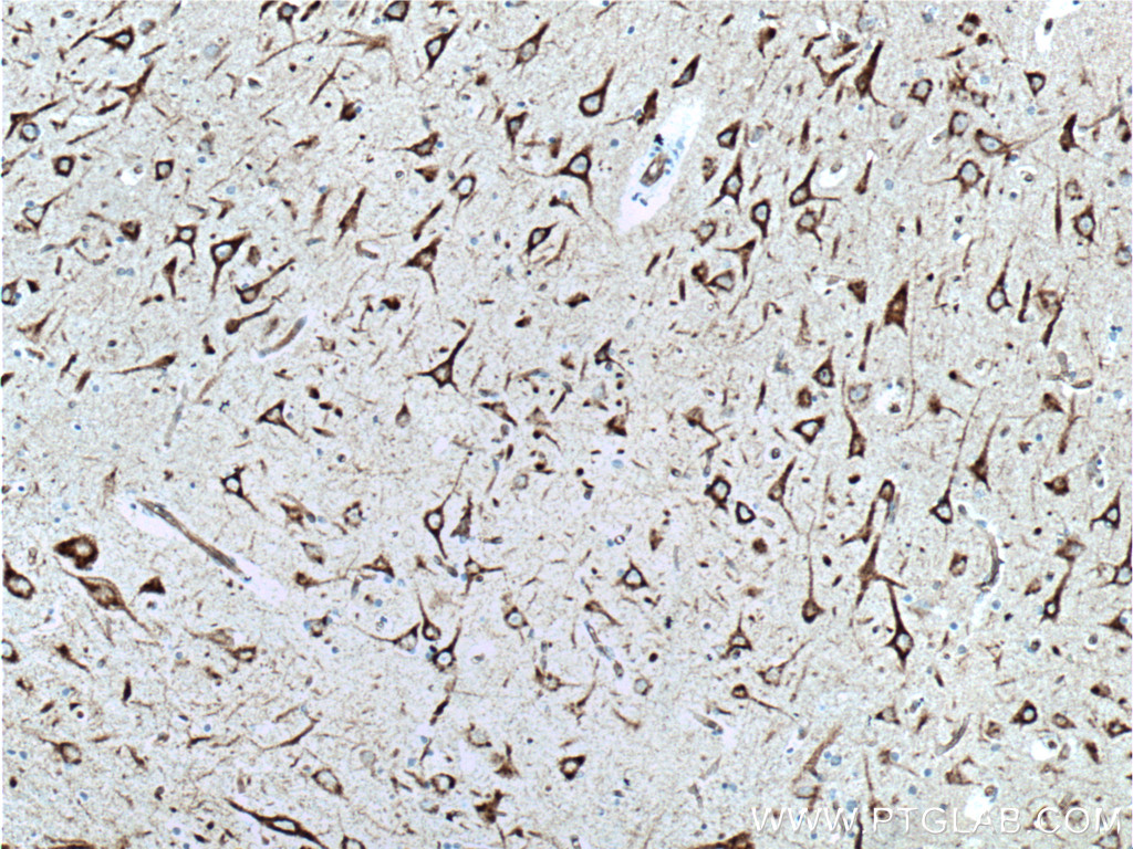 IHC staining of human brain using 24065-1-AP (same clone as 24065-1-PBS)