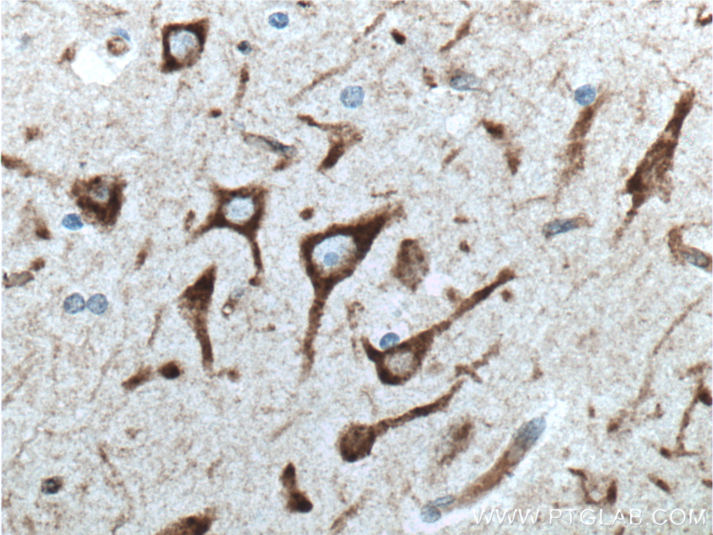 IHC staining of human brain using 24065-1-AP (same clone as 24065-1-PBS)