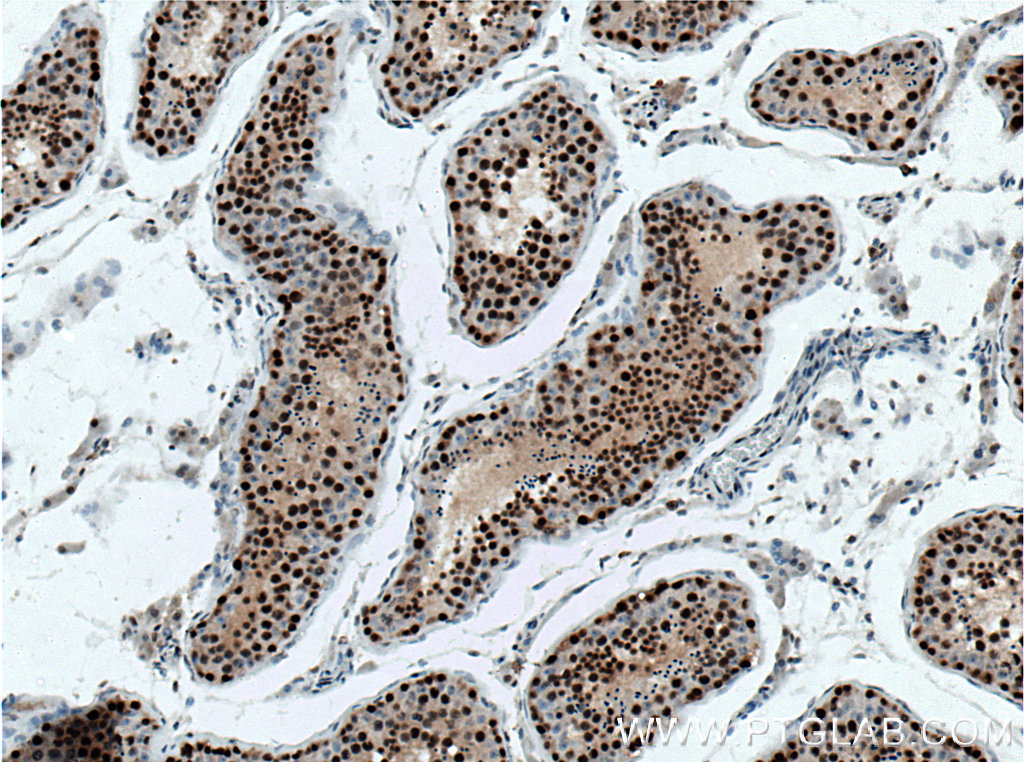 IHC staining of human testis using 66552-1-Ig