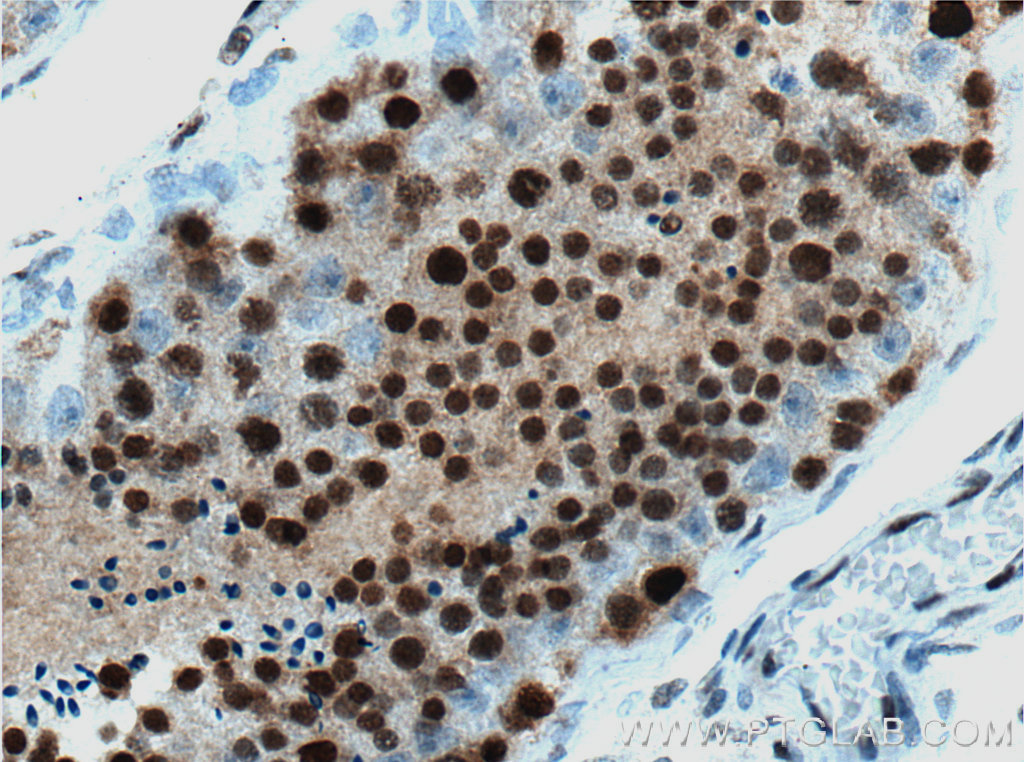 IHC staining of human testis using 66552-1-Ig