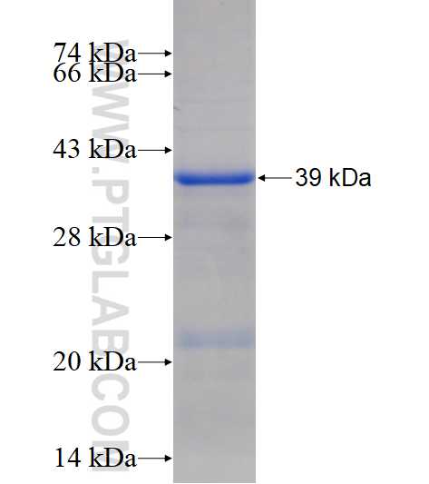 NHLRC1 fusion protein Ag17248 SDS-PAGE NHLRC1 fusion protein Ag17248 SDS-PAGE