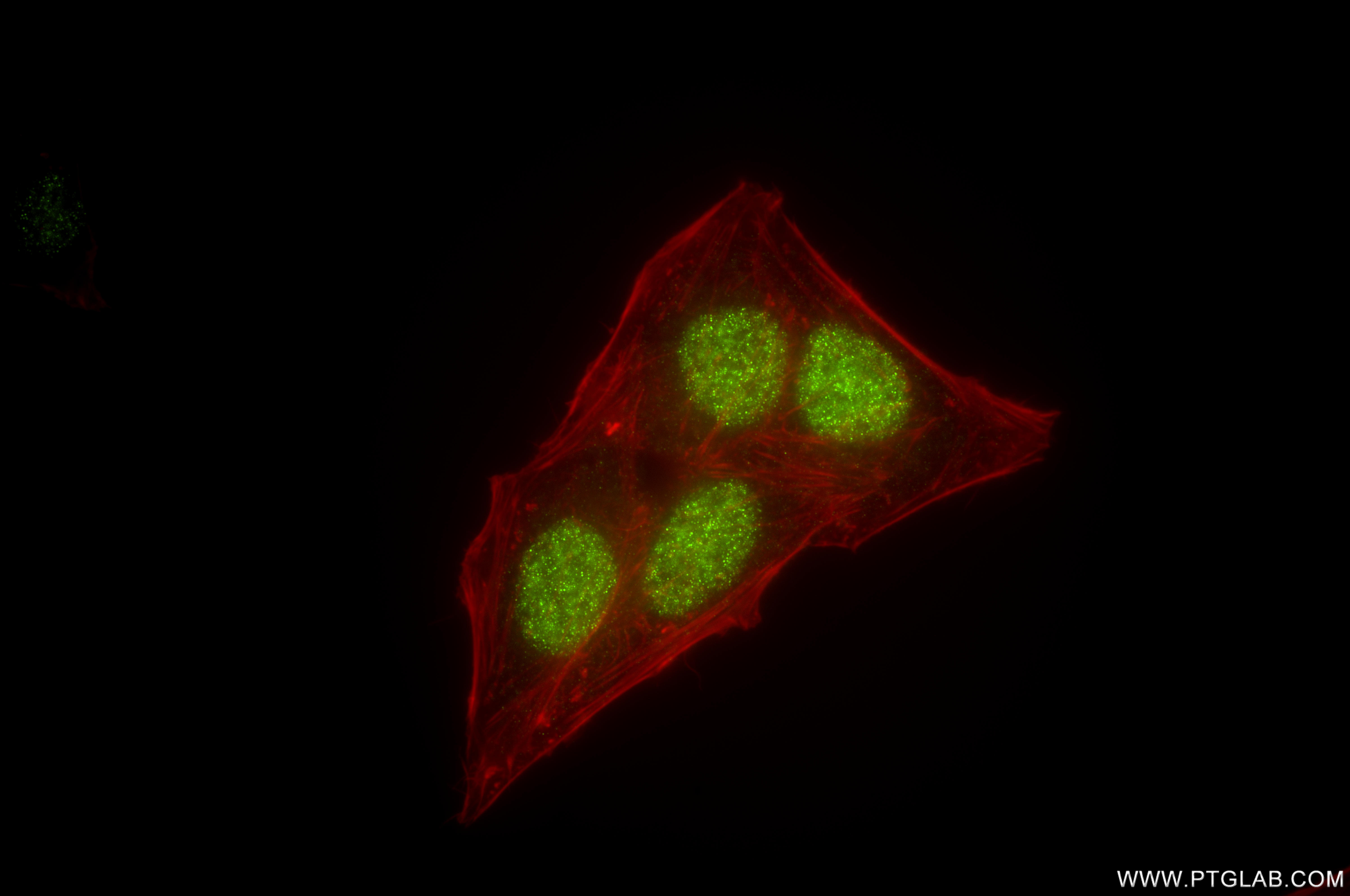 IF Staining of HepG2 using 86677-1-RR IF Staining of HepG2 using 86677-1-RR
