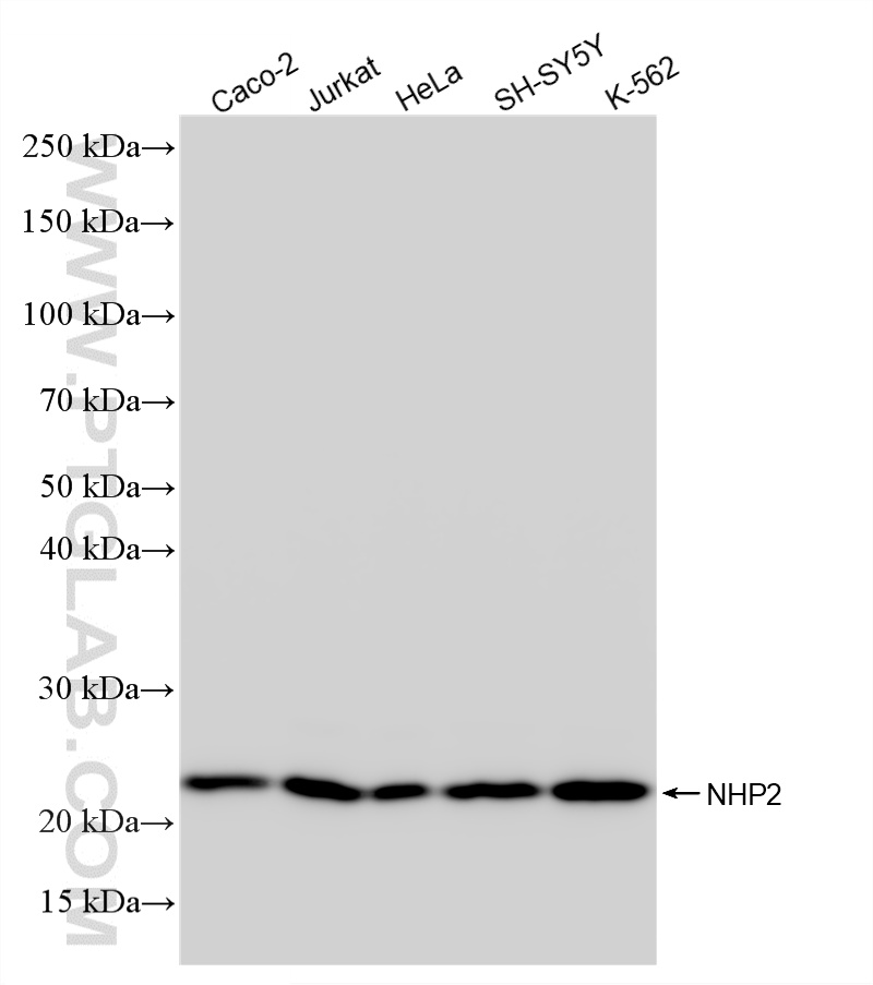 WB analysis using 86677-1-RR WB analysis using 86677-1-RR