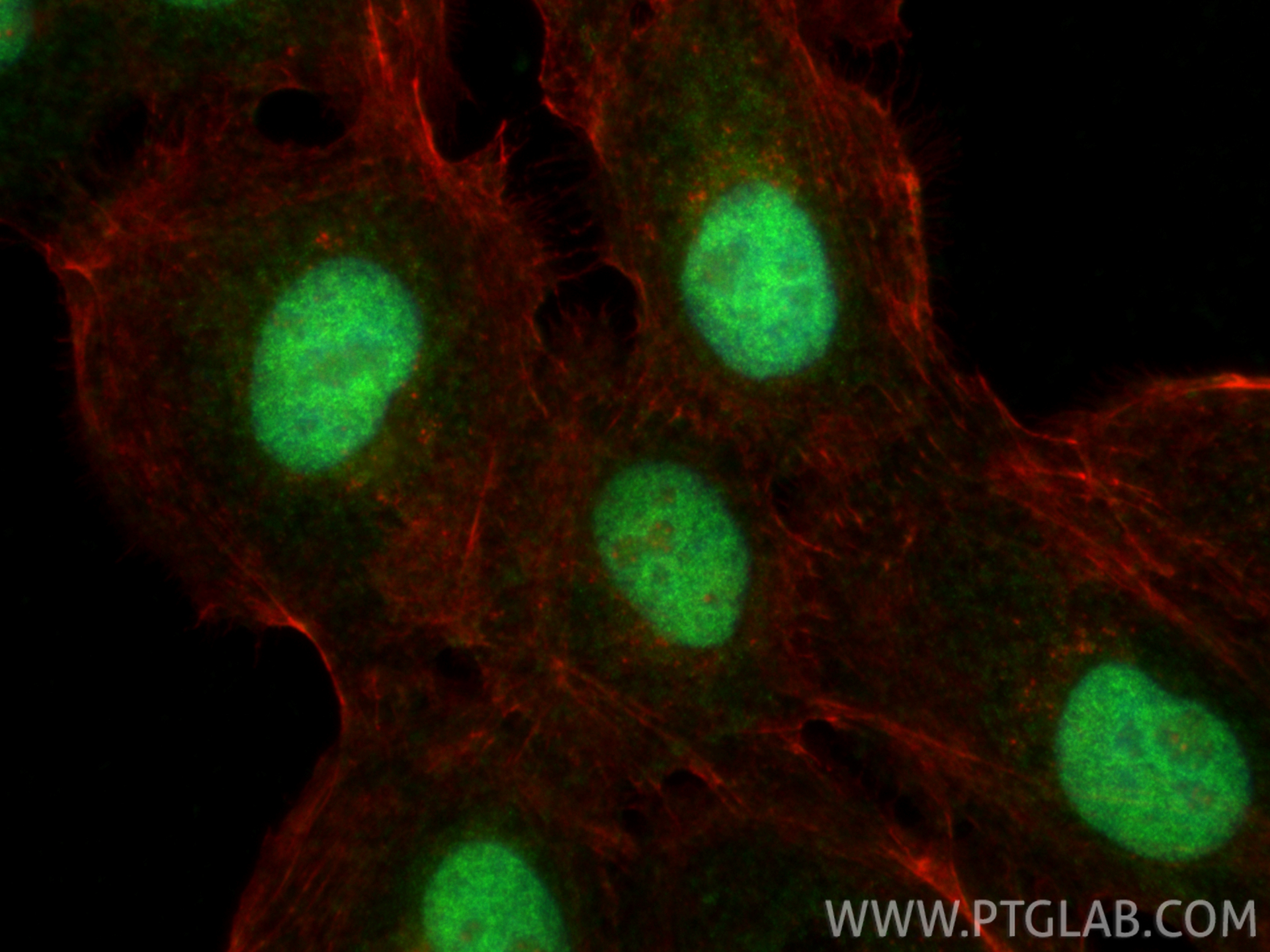 IF Staining of A431 using 15802-1-AP IF Staining of A431 using 15802-1-AP