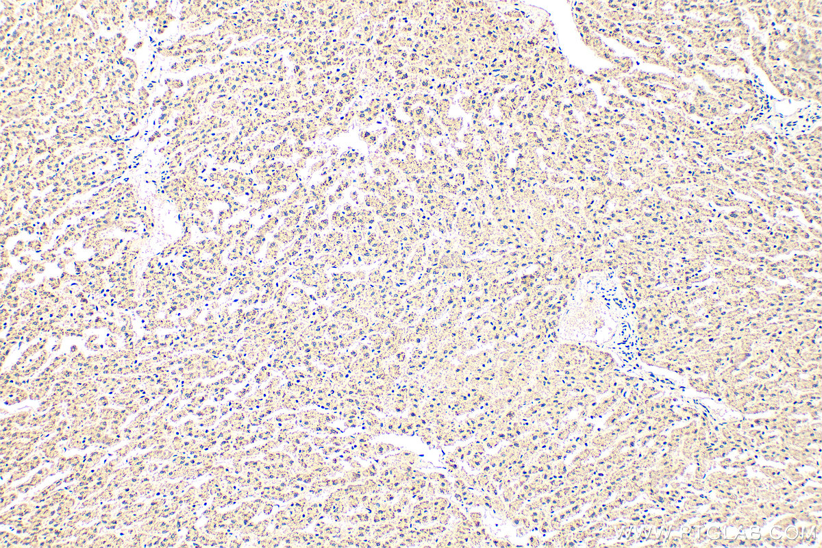 IHC staining of human liver using 31487-1-AP IHC staining of human liver using 31487-1-AP