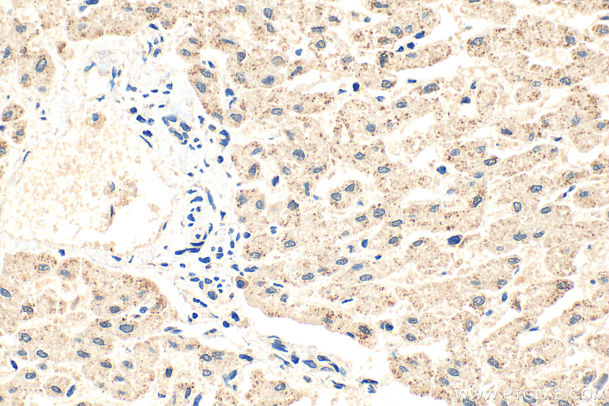 IHC staining of human liver using 31487-1-AP IHC staining of human liver using 31487-1-AP